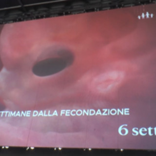 Aborto: Pro Vita &amp; Famiglia, maxi proiezione in piazza a Roma di 'Baby Olivia'