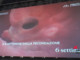 Aborto: Pro Vita &amp; Famiglia, maxi proiezione in piazza a Roma di 'Baby Olivia'